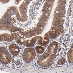 BAIAP2L2 Antibody, Novus Biologicals 25 &mu;L; Unlabeled:Antibodies, Polyclonal